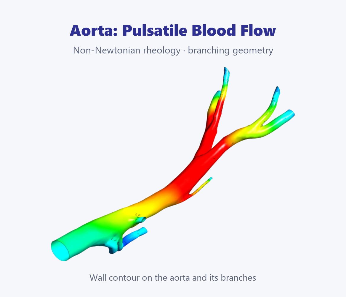 Pressure contours on an aorta geometry with branches